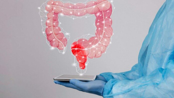 el-40--de-los-pacientes-con-cancer-colorrectal-llega-tarde-al-medico-focus-0-0-896-504